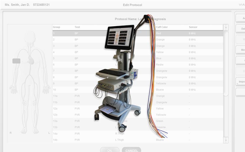 Viasonix Falcon vasculair diagnosestelsel